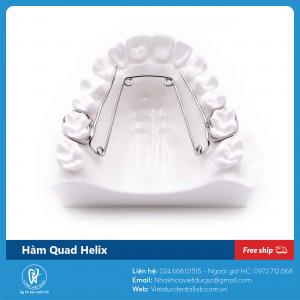 Hàm Quad Helix Việt Đức Dental Lab